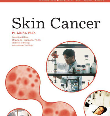 خرید و دانلود نسخه کامل کتاب Skin Cancer (The Biology of Cancer)