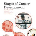 خرید و دانلود نسخه کامل کتاب Stages of Cancer Development (The Biology of Cancer)