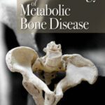 خرید و دانلود نسخه کامل کتاب The Bioarchaeology of Metabolic Bone Disease