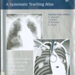خرید و دانلود نسخه کامل کتاب The Chest X-Ray-The Systematic Teaching Atlas.