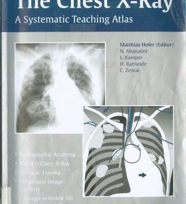 خرید و دانلود نسخه کامل کتاب The Chest X-Ray-The Systematic Teaching Atlas.