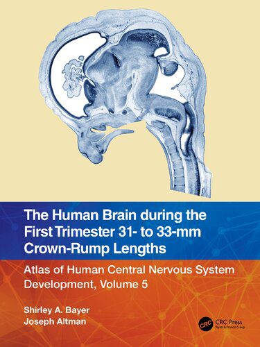 خرید و دانلود نسخه کامل کتاب The Human Brain during the First Trimester 31- to 33-mm Crown-Rump Lengths_68e23b0357f67.jpeg خرید و دانلود نسخه کامل کتاب The Human Brain during the First Trimester 31- to 33-mm Crown-Rump Lengths