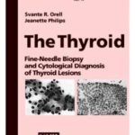 خرید و دانلود نسخه کامل کتاب The Thyroid: Fine-Needle Biopsy and Cytological Diagnosis of Thyroid Lesions (Monographs in Clinical Cytology)