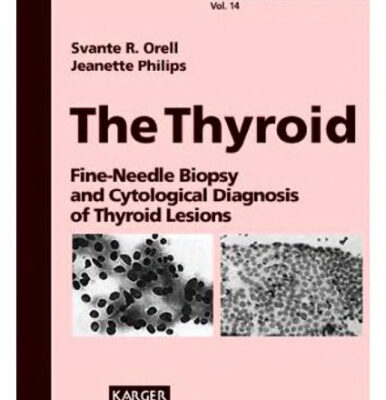 خرید و دانلود نسخه کامل کتاب The Thyroid: Fine-Needle Biopsy and Cytological Diagnosis of Thyroid Lesions (Monographs in Clinical Cytology)