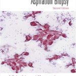 خرید و دانلود نسخه کامل کتاب Transabdominal Fine-Needle Aspiration Biopsy: A Color Atlas and Monograph, 2nd edition