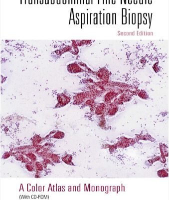 خرید و دانلود نسخه کامل کتاب Transabdominal Fine-Needle Aspiration Biopsy: A Color Atlas and Monograph, 2nd edition