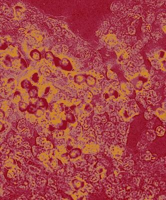 خرید و دانلود نسخه کامل کتاب Tumor Suppressor Genes: Volume 2 Regulation, Function, and Medicinal Applications