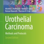خرید و دانلود نسخه کامل کتاب Urothelial Carcinoma: Methods and Protocols