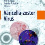 خرید و دانلود نسخه کامل کتاب Varicella-zoster Virus