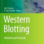 خرید و دانلود نسخه کامل کتاب Western Blotting: Methods and Protocols