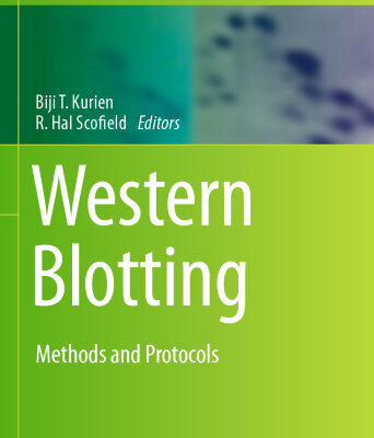 خرید و دانلود نسخه کامل کتاب Western Blotting: Methods and Protocols