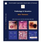 خرید و دانلود نسخه کامل کتاب World Health Organization Classification of Tumours Pathology and Genetics of Tumours of the Skin