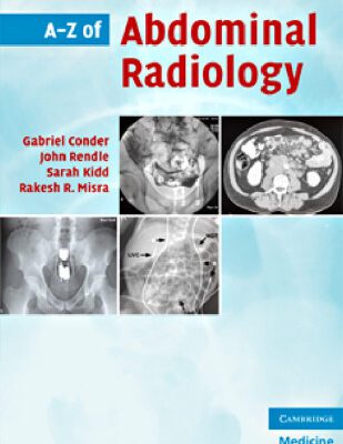 خرید و دانلود نسخه کامل کتاب A-Z of Abdominal Radiology