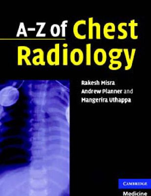 خرید و دانلود نسخه کامل کتاب A-Z of Chest Radiology
