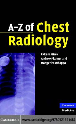 خرید و دانلود نسخه کامل کتاب A-Z of Chest Radiology_690711cc72ab2.jpeg خرید و دانلود نسخه کامل کتاب A-Z of Chest Radiology