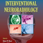 خرید و دانلود نسخه کامل کتاب Interventional Neuroradiology