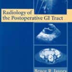 خرید و دانلود نسخه کامل کتاب Radiology of the Postoperative GI Tract