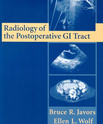 خرید و دانلود نسخه کامل کتاب Radiology of the Postoperative GI Tract