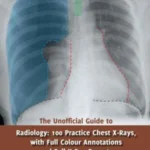 خرید و دانلود راهنمای غیررسمی رادیولوژی: 100 تمرین تفسیر گرافی قفسه سینه 2017 ویرایش اول