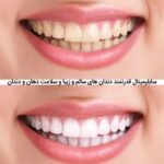 خرید و دانلود نسخه کامل سابلیمینال فارسی دندان های سالم و زیبا و سلامت دهان و دندان