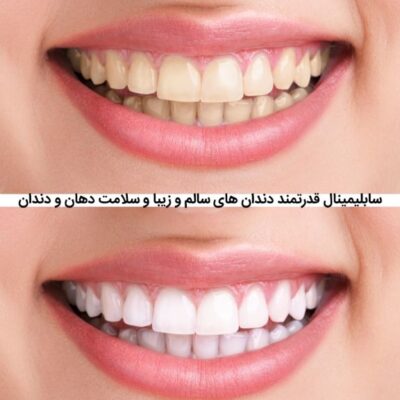 خرید و دانلود نسخه کامل سابلیمینال فارسی دندان های سالم و زیبا و سلامت دهان و دندان