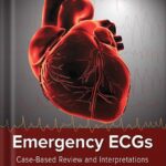 خرید و دانلود نسخه کامل کتاب Emergency ECGs: Case-Based Review and Interpretations by Jeremy Berberian PDF