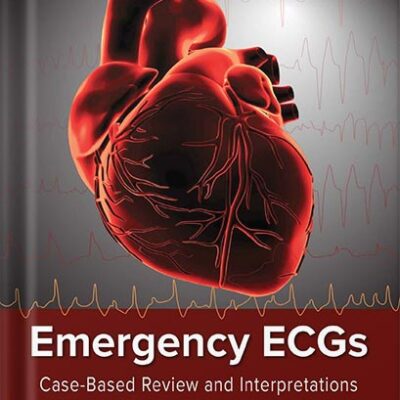 خرید و دانلود نسخه کامل کتاب Emergency ECGs: Case-Based Review and Interpretations by Jeremy Berberian PDF