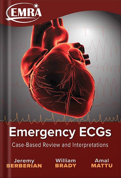 225-New-PNG-Version-101 خرید و دانلود نسخه کامل کتاب Emergency ECGs: Case-Based Review and Interpretations by Jeremy Berberian PDF - تصویر 1