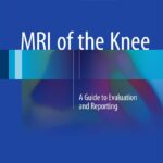 دانلود کتاب MRI of the Knee: A Guide to Evaluation and Reporting 2015th Edition