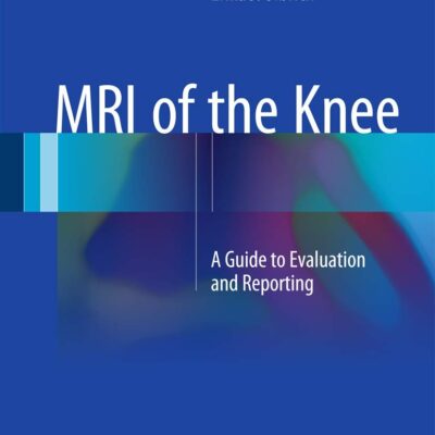 دانلود کتاب MRI of the Knee: A Guide to Evaluation and Reporting 2015th Edition