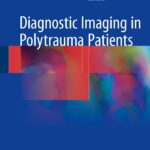 دانلود کتاب Diagnostic Imaging in Polytrauma Patients 1st ed