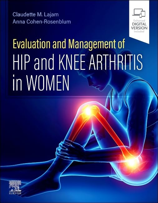 51gKaEviKmL خرید و دانلود نسخه کامل کتاب Evaluation and Management of Hip and Knee Arthritis in Women 1st Edition