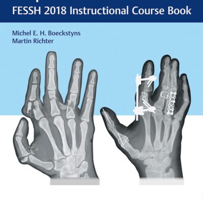 دانلود کتاب Fractures of the Hand and Carpus: FESSH 2018 Instructional Course Book 1st Edition