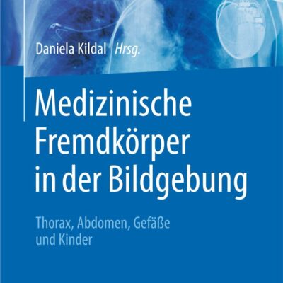 دانلود کتاب Medizinische Fremdkörper in der Bildgebung: Thorax, Abdomen, Gefäße und Kinder