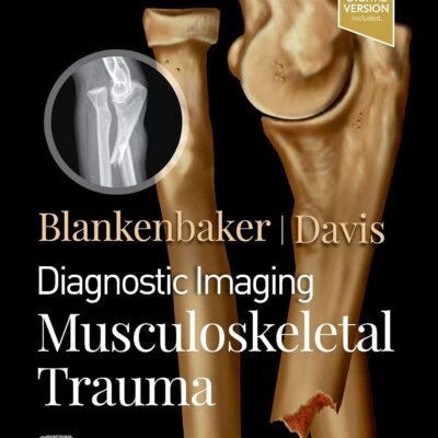 دانلود کتاب Diagnostic Imaging: Musculoskeletal Trauma 3rd Edition ویرایش سوم