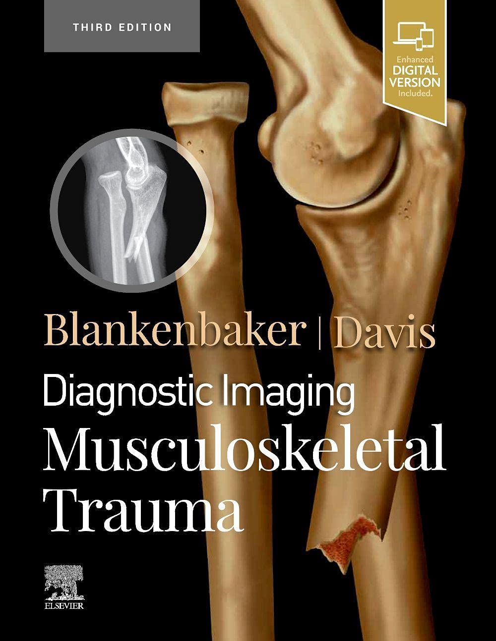61F4WJTtYYS._SL1294_ دانلود کتاب Diagnostic Imaging: Musculoskeletal Trauma 3rd Edition ویرایش سوم