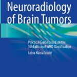 دانلود کتاب Neuroradiology of Brain Tumors: Practical Guide based on the 5th Edition of WHO Classification 1st ed. 2023 Edition