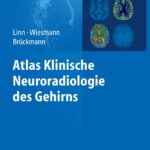 دانلود کتاب Atlas Klinische Neuroradiologie des Gehirns 1st Edition