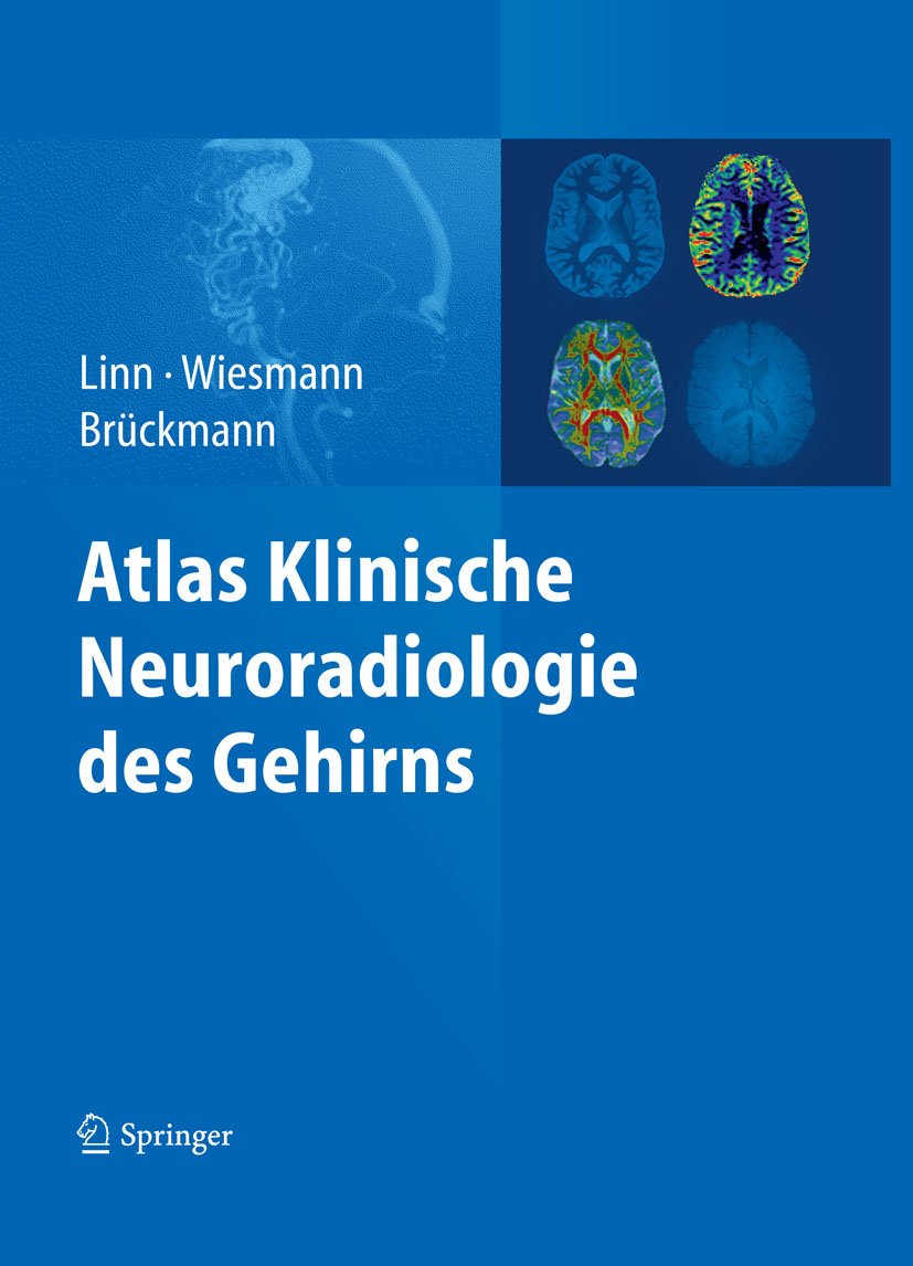 61q5SpTfHxL._SL1146_ دانلود کتاب Atlas Klinische Neuroradiologie des Gehirns 1st Edition