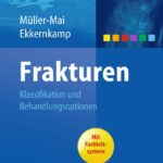 دانلود کتاب Frakturen: Klassifikation und Behandlungsoptionen