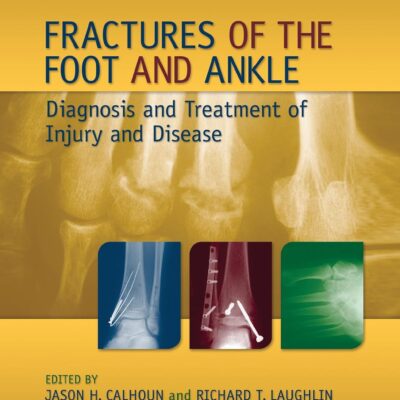 دانلود کتاب Fractures of the Foot and Ankle: Diagnosis and Treatment of Injury and Disease 1st Edition
