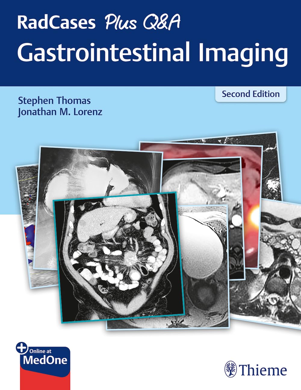 71nnYnQddrL._SL1296_ دانلود کتاب RadCases Plus Q&A Gastrointestinal Imaging 2nd Edition