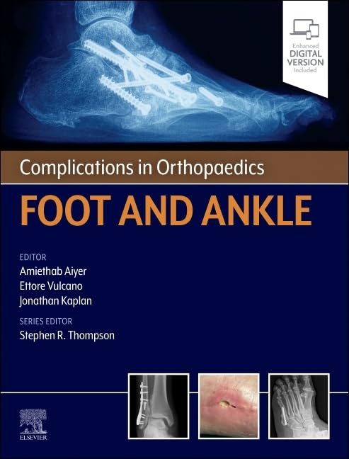 51XFiBUxjAL خرید و دانلود نسخه کامل کتاب Complications in Orthopaedics: Foot and Ankle 1st edition + pdf