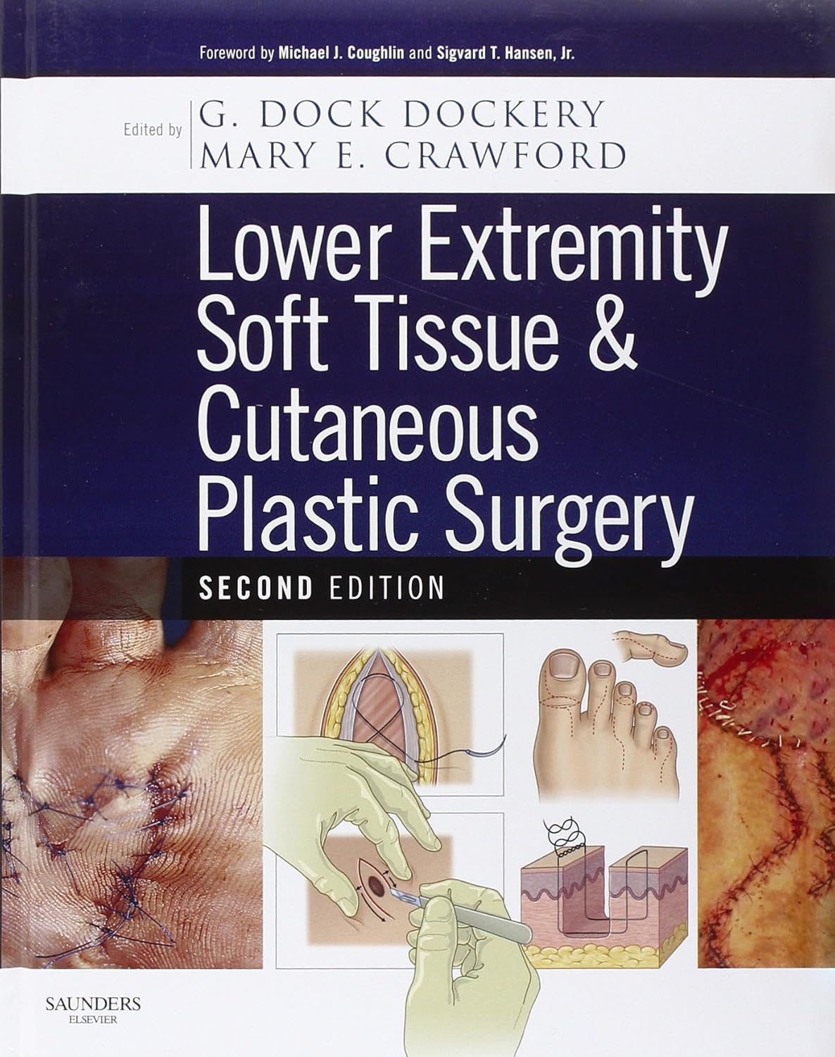 81qdB5FEmQL._SL1500_ خرید و دانلود نسخه کامل کتاب Lower Extremity Soft Tissue & Cutaneous Plastic Surgery 2nd edition + pdf