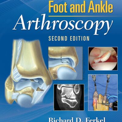 خرید و دانلود نسخه کامل کتاب Foot & Ankle Arthroscopy 2nd edition + pdf