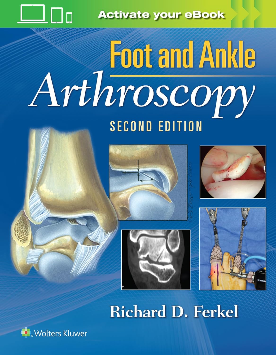 81rfz3XXkgL._SL1500_ خرید و دانلود نسخه کامل کتاب Foot & Ankle Arthroscopy 2nd edition + pdf