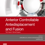 خرید و دانلود نسخه کامل کتاب 
Anterior Controllable Antedisplacement and Fusion (ACAF): Technique in Spinal Surgery
