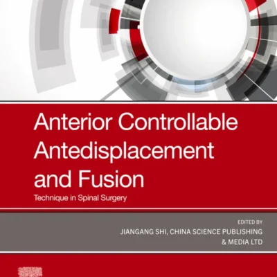 خرید و دانلود نسخه کامل کتاب 
Anterior Controllable Antedisplacement and Fusion (ACAF): Technique in Spinal Surgery