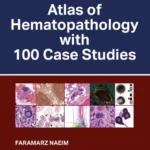 خرید و دانلود نسخه کامل کتاب 
Atlas of Hematopathology with 100 Case Studies