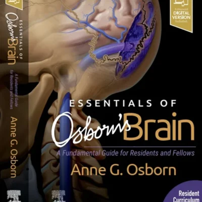 خرید و دانلود نسخه کامل کتاب 
Essentials of Osborn's Brain: A Fundamental Guide for Residents and Fellows